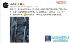 小智术后阿怡细心呵护 人送外号“智嫂”,lol日服